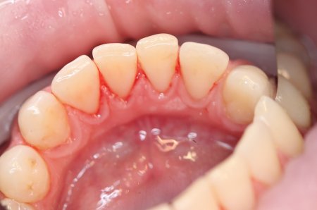 укекуекуеуке