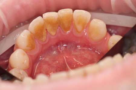 укекуекуеуке